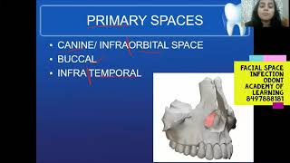 FACIAL SPACE INFECTION [upl. by Bebe]