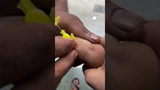 7 month baby ko canula kaisa lgay 🤔foryou shortvideos viral doctor viralvideos explore sad [upl. by Kraft]