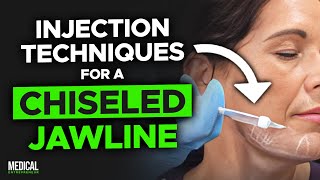 How to Get Rid of Jowls with Filler  Full Procedure Demonstration [upl. by Neirual]