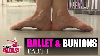 Ballet amp Bunions Part I How To Stretch Strengthen amp Prevent Pain with Ballerina Badass [upl. by Eelirem]