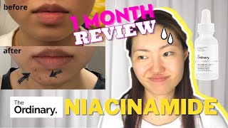 Trying The Ordinary Niacinamide 10  Zinc 1  1 Month Honest Review Yay or Nah [upl. by Hinkle]