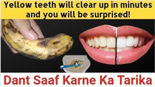 Yellow teeth will clear up in minutes and you will be surprised  Dant Saaf Karne Ka Tarika [upl. by Juli]