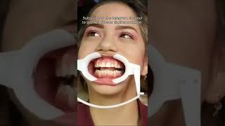 Dentist places lip retractor on girl for treatment [upl. by Stanly705]