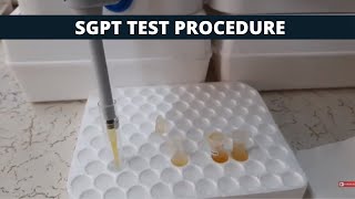 SGPT Test Procedure  SGPT Simple Test Procedure [upl. by Ramyaj647]