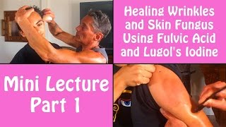 Healing Wrinkles and Skin Fungus Using Fulvic Acid and Lugols Iodine Part 1  Dr Robert Cassar [upl. by Hceicjow]