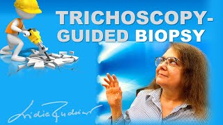 How to make a trichoscopyguided scalp biopsy [upl. by Atteuqihc191]