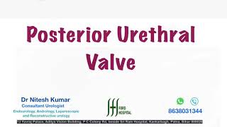 Posterior Urethral Valve [upl. by Analad]