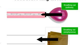 How a muscle contraction is signalled  Animation [upl. by Ttesil405]