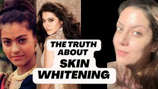 Bollywood Actress Skin Whitening Treatment I Whitening Injection I Whitening Treatment for Skin [upl. by Carman481]