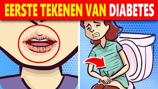 10 Vroege Tekenen En Symptomen Van Diabetes Waar Je Op Moet Letten [upl. by Xonnel]