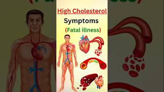 STOP Ignoring These Warning Signs of High Cholesterol [upl. by Idona]