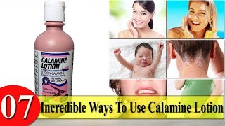 CALAMINE lotion  Lacto calamine lotion uses in detail side effects [upl. by Anton]