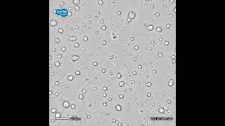 Time lapse of the growth of HepG2 spheroids  CytoSMART Lux2 [upl. by Ylrehs]