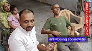 ankylosingspondylitis पीड़ित रोगीजन ध्यान दें 📢 [upl. by Photima]