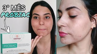 RESENHA PROBIAC EXIMIA 3° MÊS  ACNE HORMONAL  CRIS MARIA [upl. by Lazare330]