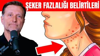 Çok Fazla Şeker Tükettiğinizin 7 İşareti  Dr Berg Türkçe [upl. by Melany]