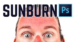 How to Get Rid of Sunburn almost Instantly PHOTOSHOP [upl. by O'Conner]