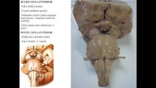 ANATOMIA MACROSCÓPICA DO SNC PARTE 1  TRONCO ENCEFÁLICO [upl. by Sill515]