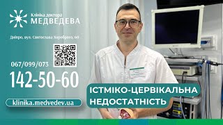 Істміко цервікальна недостатність [upl. by Jewel]