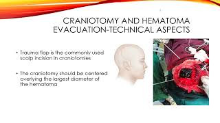 F Burr Holes and Craniotomy ver 2 [upl. by Camila]