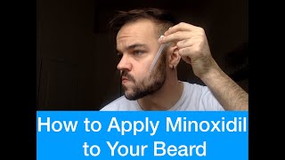 How to Apply Minoxidil to Your Beard For Beginners [upl. by Assisi]