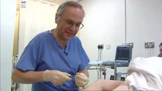 Foam sclerotherapy for varicose veins  a patients view  Philip Coleridge Smith [upl. by Bogosian436]