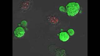 H2O2induced necrotic L929 cells  Morphology ROS amp PI uptake overlay [upl. by Ong]