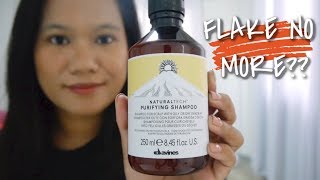 IS IT EFFECTIVE  DAVINES PURIFYING SHAMPOO  SEBORRHEIC DERMATITIS [upl. by Egiap337]