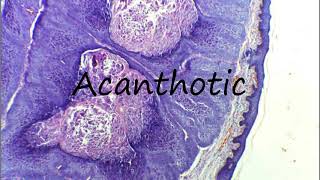 How to Pronounce Acanthotic [upl. by Egiaf114]