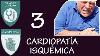 Cardiopatía Isquémica 3  Angina estable e Inestable [upl. by Alexandrina388]