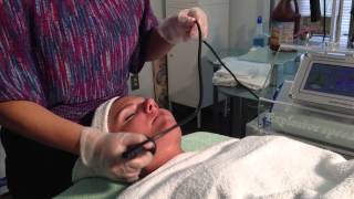 radio frequency ultra lift skin tightening [upl. by Yesnik]