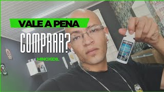 MINOXIDIL FINASTERIDA ANTES E DEPOIS [upl. by Nimoynib]