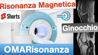 Risonanza Magnetica 🧲 del Ginocchio  Shorts menisco radiologia paziente 👇 [upl. by Ron]