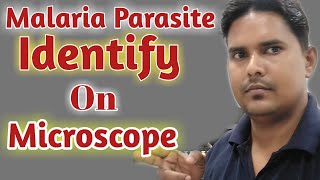 Malaria parasite under microscope  Malaria parasite procedure  P vivax malaria in hindi [upl. by Ecyar318]