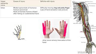 Upper Extremity Nerve Injury  MSK  Step 1 Simplified [upl. by Anoblav]