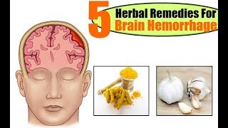 Top 5 Herbal Remedies For Brain Hemorrhage [upl. by Stephana]