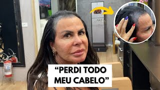 Tudo sobre a queda de cabelo da Gretchen  VEJA A TRASFORMAÇÃO  VÍDEO COMPLETO [upl. by Estevan721]