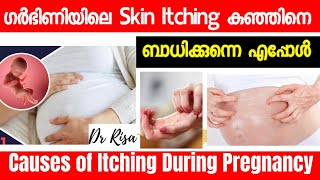 Itching During Pregnancy Malayalam  Pregnancy Strech Mark  Cholestasis [upl. by Assirhc]