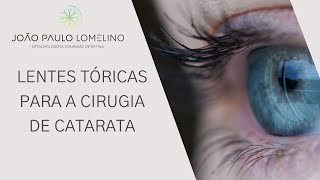 Lentes tóricas para a cirurgia de catarata  Dr João Paulo Lomelino [upl. by Lati966]