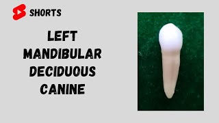 Left Deciduous Mandibular Canine  Oral Anatomy [upl. by Leanor]