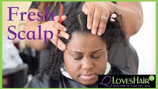 Fresh Scalp Treatment [upl. by Allenad]