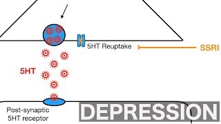 Major Depression and SSRIsSNRIs [upl. by Crain546]