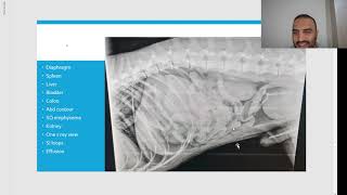 Chapter 6 Lets study X rays 13 الجدPeritonealamp retroperitoneal free fluid amp gas سوائل هواء البطن [upl. by Kroo]