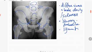 MSK case 42 [upl. by Eromle]