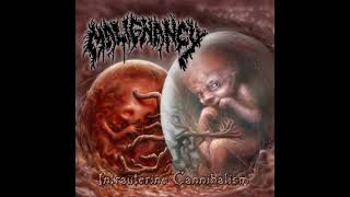 Malignancy  Intrauterine Cannibalism ReRecorded Full Album [upl. by Bibah853]