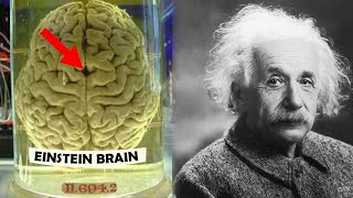 How Einsteins Brain was Different [upl. by Eidoj229]