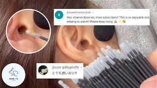 ASMR  ミクロスワブで最高の耳かき体験  Best Ear Cleaning Experience With Micro Swabs [upl. by Magnusson754]