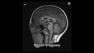 Anatomia radiologiczna Rezonans magnetyczny głowa obraz T1 Pień mózgu  rdzeń kręgowy [upl. by Tabbitha221]