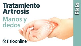 Tratamiento de fisioterapia para la artrosis de manos y dedos [upl. by Nnyltiac]