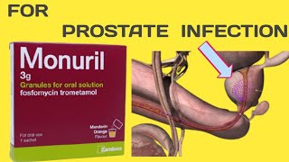 Monuril For Prostate Infection [upl. by Anale]